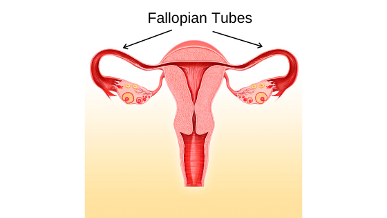 Fallopian_Tube_Issues_IVF